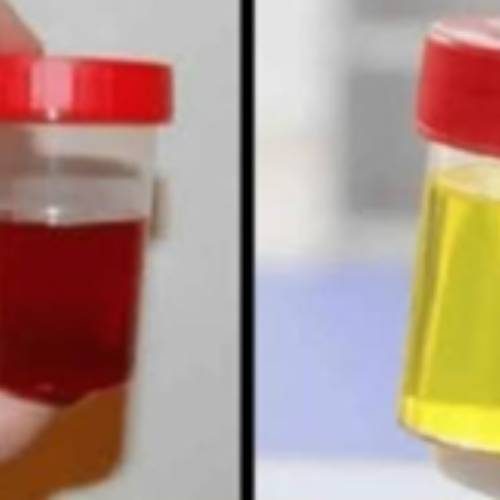 الأبقار
